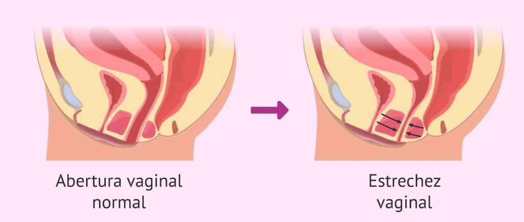 Relaciones Sexuales Dolorosas médico especialista