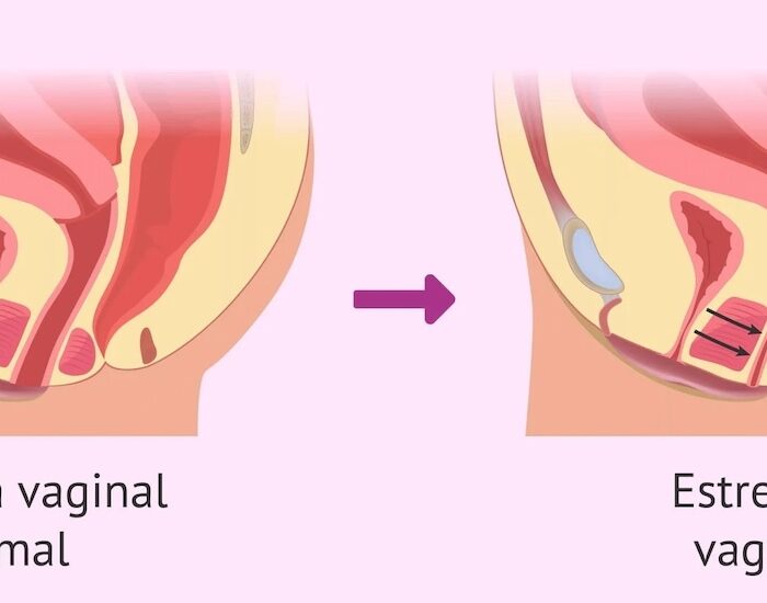 Relaciones Sexuales Dolorosas médico especialista