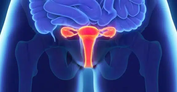 Atrofia Vaginal
