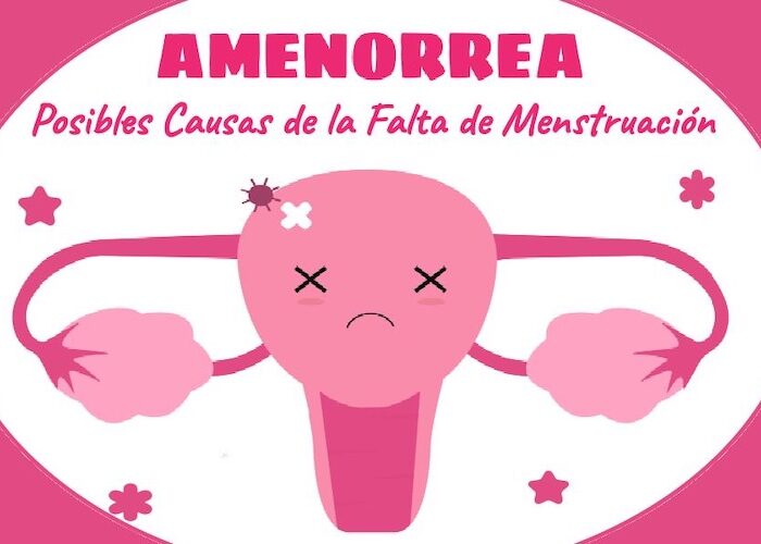 amenorrea atención médica en santiago