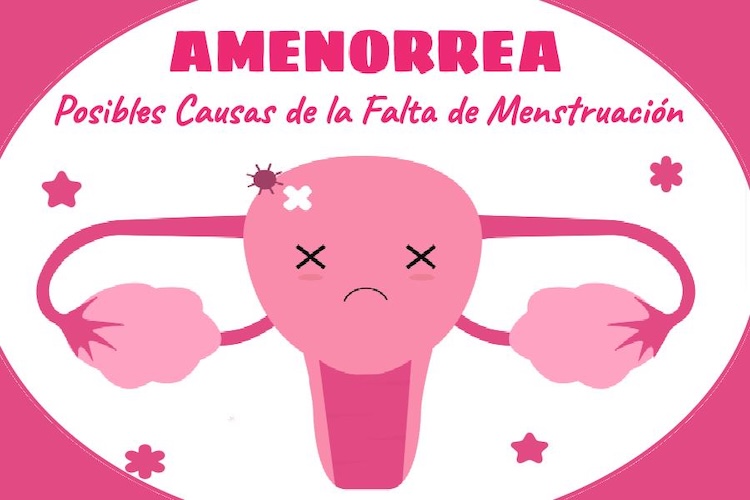 amenorrea atención médica en santiago