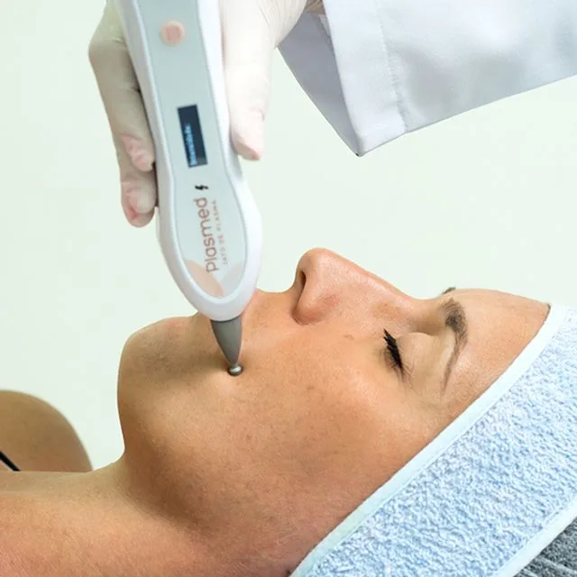 Tratamiento con Plasma