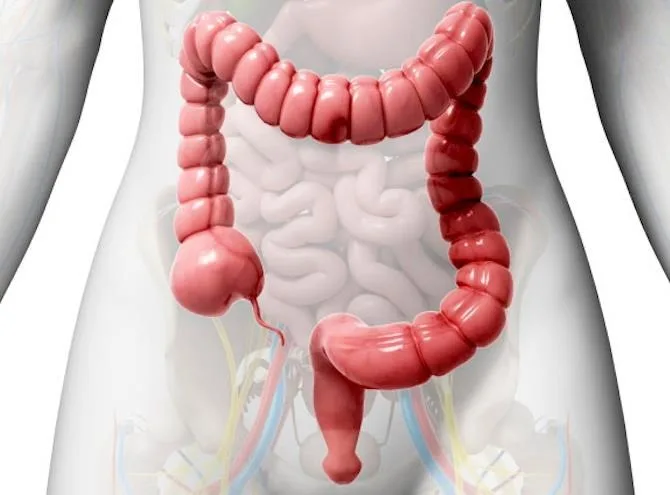 colon irritable