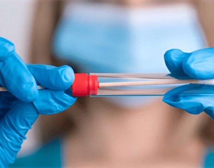 pcr para vph urgente