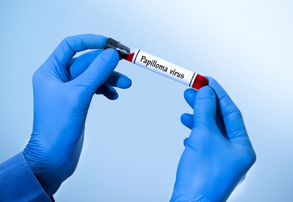 PCR para evaluación de VPH