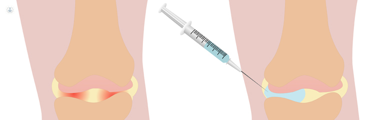 reumatólogo para infiltración de articulaciones