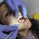 diagnóstico dental, Operatoria Dental General, tratamiento de caries