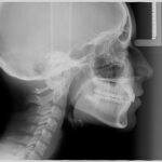 radiografía ortodoncia
