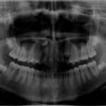 inicio tratamiento de ortodoncia