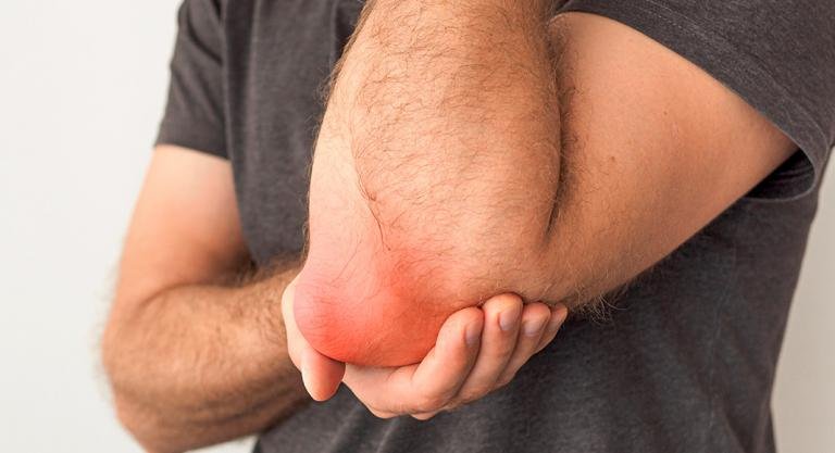 bursitis y tratamiento médico en santiago