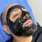 Máscara facial para puntos negros