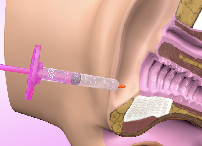 lubricación del canal vaginal
