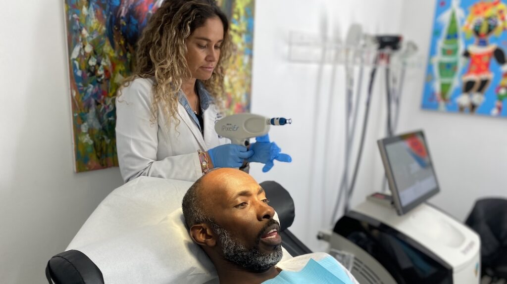 alopecia androgénica con tratamiento en santiago