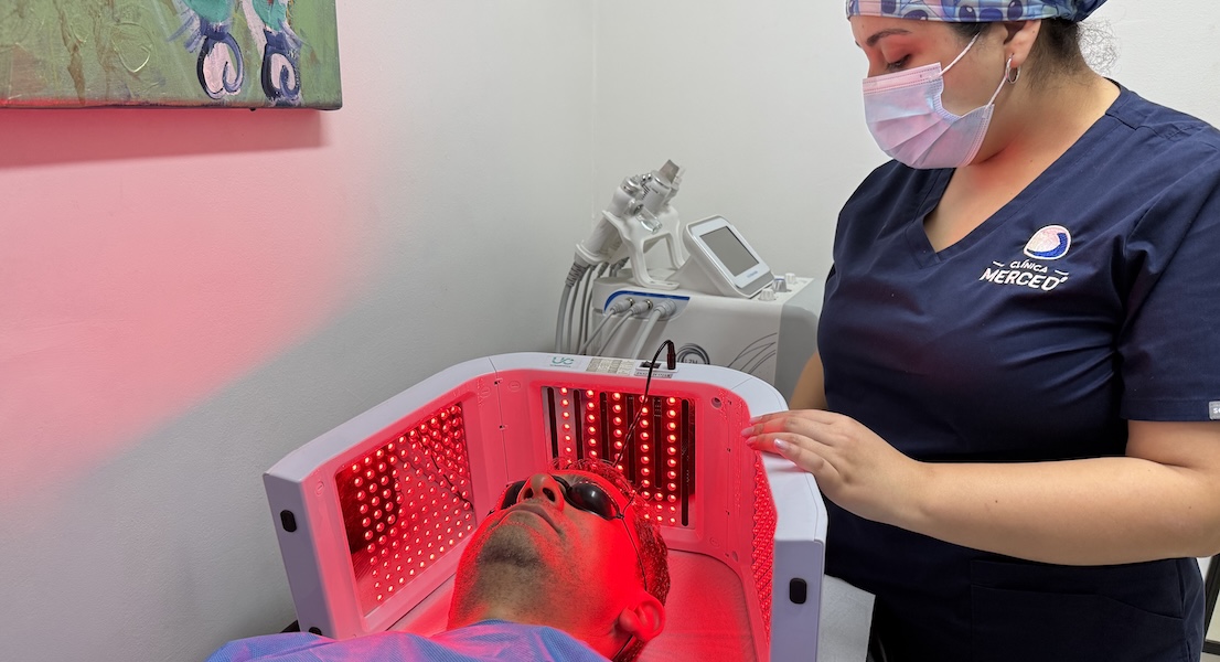 fotorepia capilar para tratar la alopecia