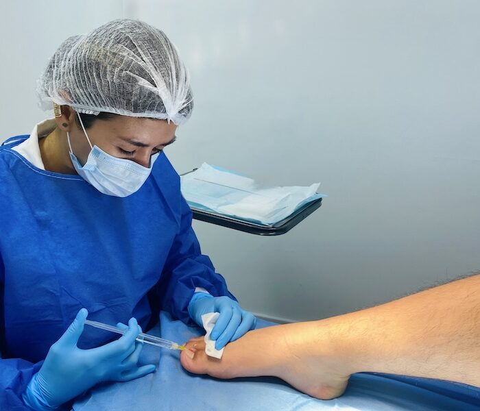 matricectomía cirugía de urgencia