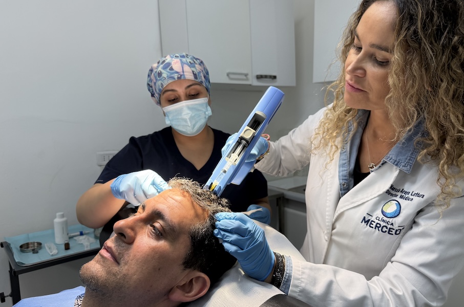 plasma capilar. prp para la caída del cabello