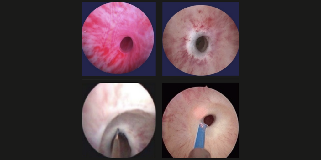 Uretromeatotomía en providencia