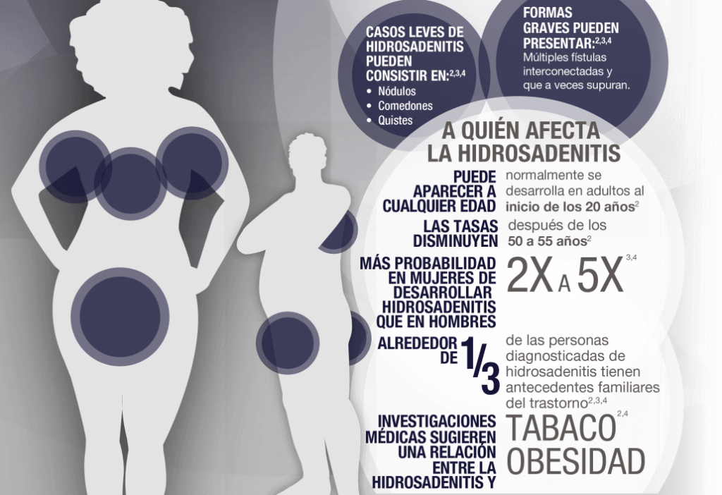 hidradenitis supurativa en cuerpo tratamiento médico