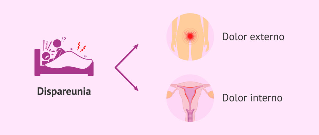 orgasmo doloroso atención médica de urgencia