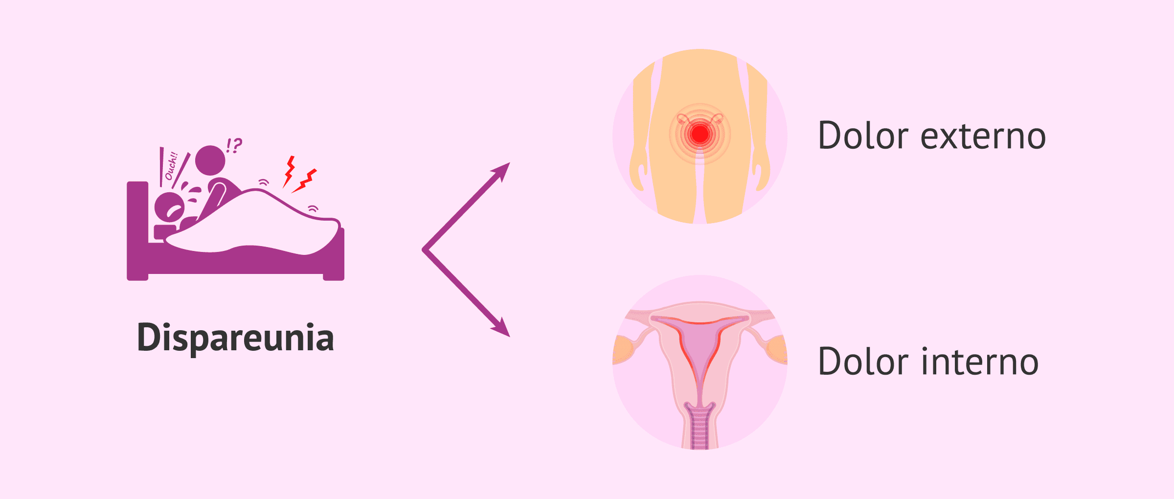 orgasmo doloroso atención médica de urgencia