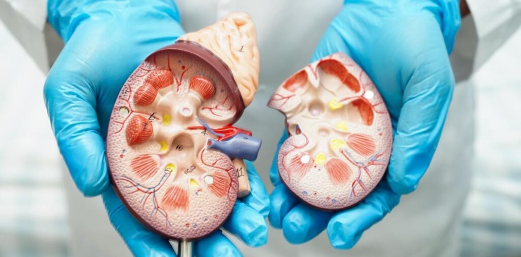 Litiasis renal. Nefrólogo en providencia
