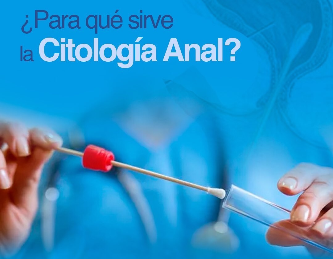 PAP Anal y tratamiento de vph