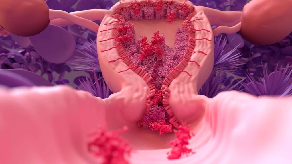 Evaluación de Endometrio en menopausia con histeroscopio