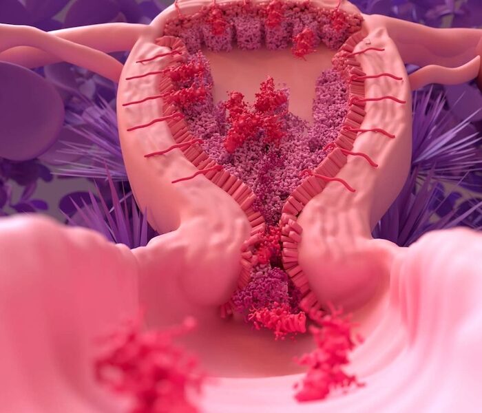 Evaluación de Endometrio en menopausia con histeroscopio