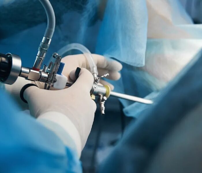 Infertilidad y Abortos Recurrentes. diagnóstico e histeroscopía