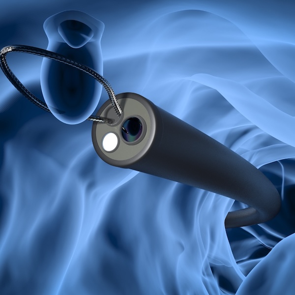 endoscopía ginecológica