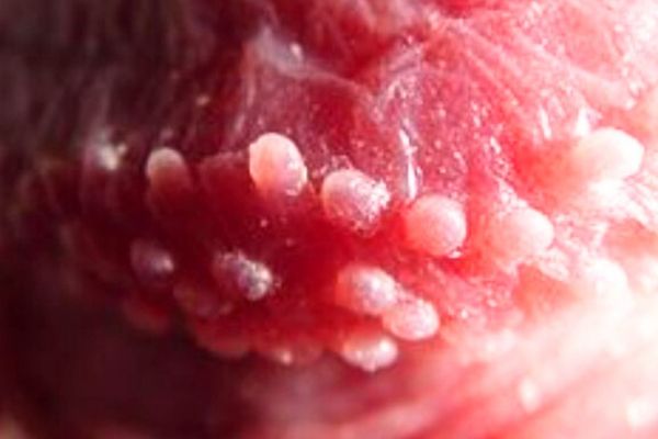 pequeñas protuberancias blanquecinas