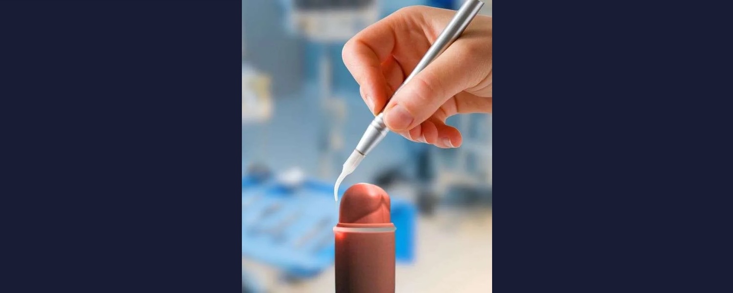 Circuncisión Láser en santiago y a precio anticipado