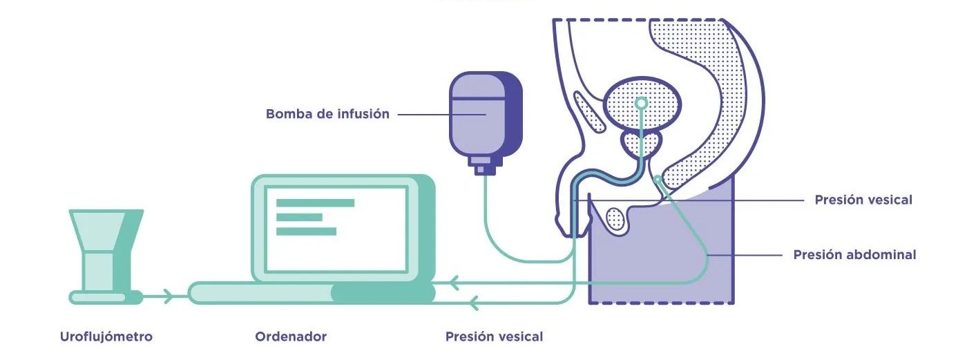 urodinamia en santiago