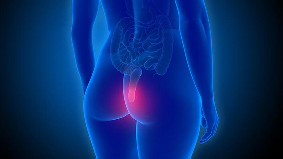 Sangrado Rectal y atención de urgencia