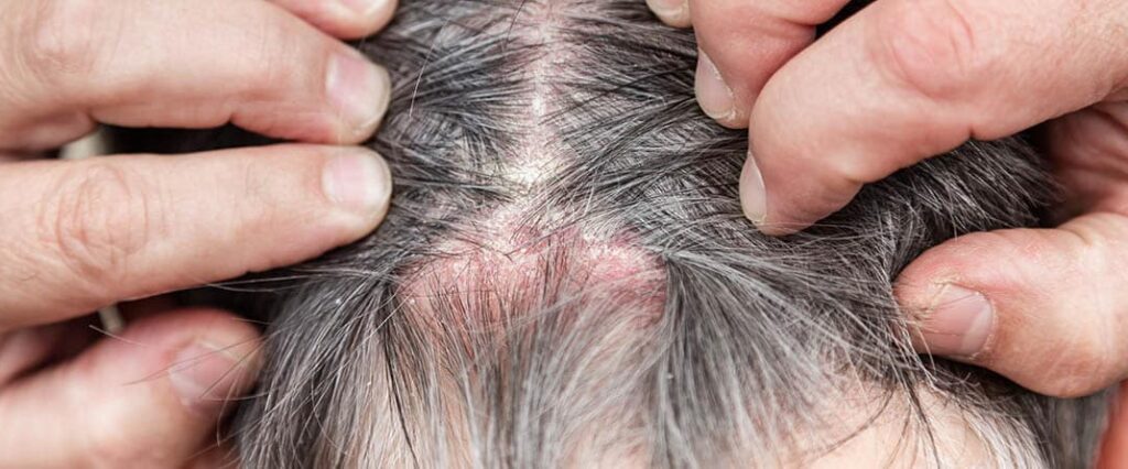 Tricodinia ozonoterapia y alivio del dolor