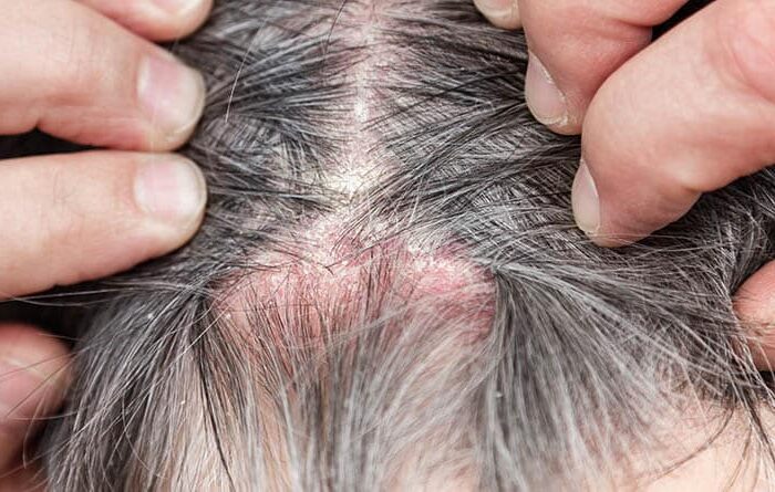 Tricodinia ozonoterapia y alivio del dolor