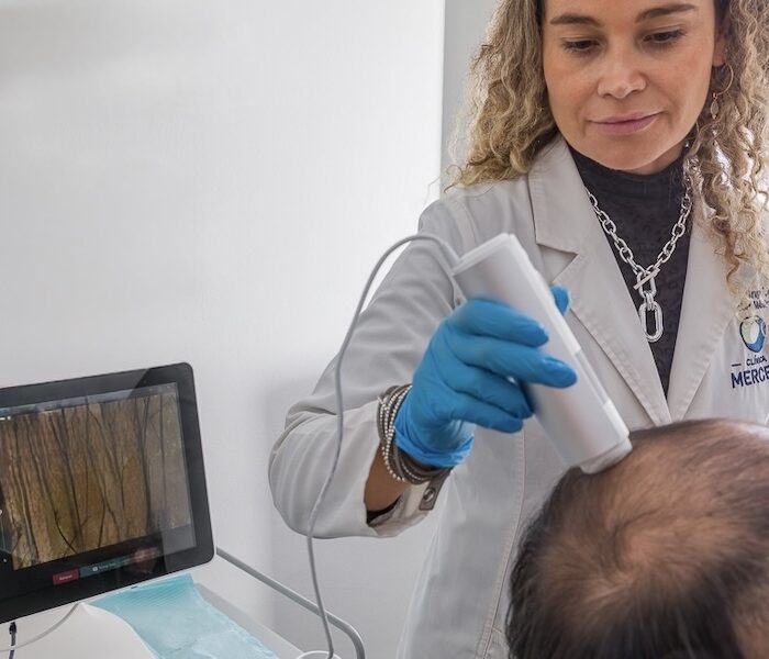 Capilografía Digital examen en santiago