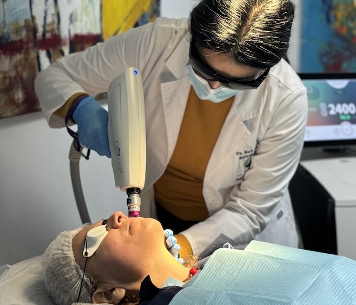 Arrugas Periorales y tratamiento dermatológico