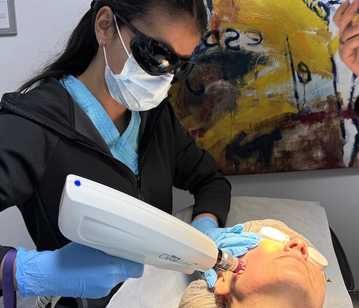 Arrugas Periorbitales y tratamiento médico en santiago