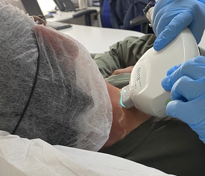 Hemangiomas Cavernosos tratamiento médico en santiago