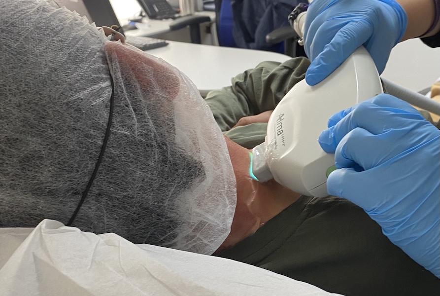 Hemangiomas Cavernosos tratamiento médico en santiago