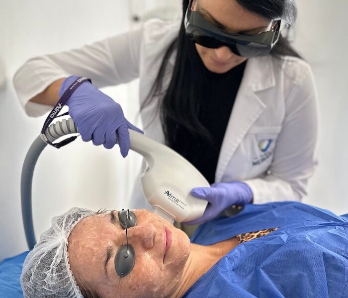 Hemangiomas Rubí con tratamiento médico