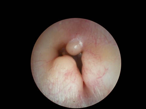 Lesiones del Oído Externo y/o Medio curación de urgencia