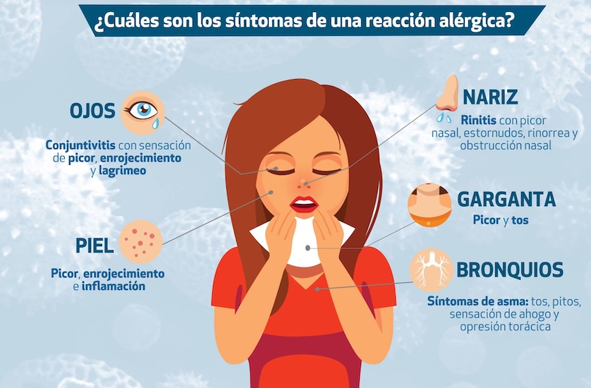 médico especialista en tratar Alergias Respiratorias