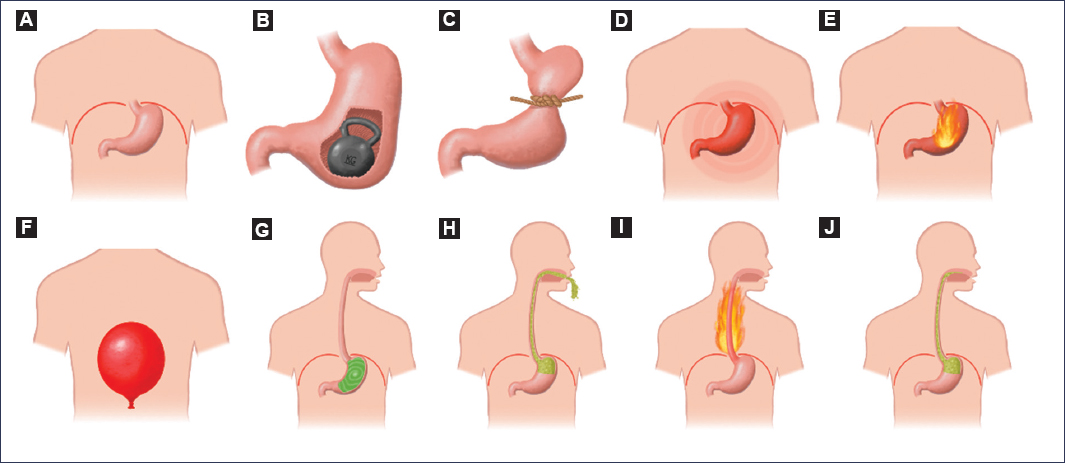 Dispepsia Funcional atención médica de urgencia