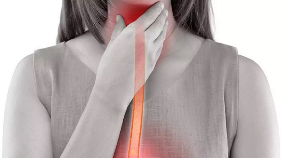 Esofagitis médico gastroenterólogo