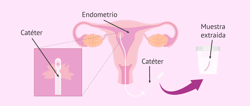 Biopsia Vaginal con médico especialista