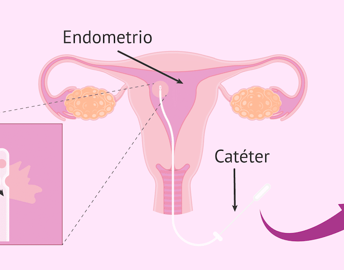 Biopsia Vaginal con médico especialista