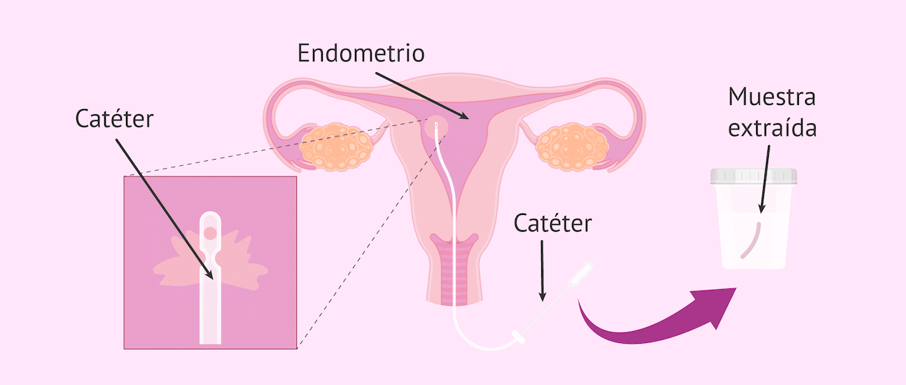 Biopsia Vaginal con médico especialista