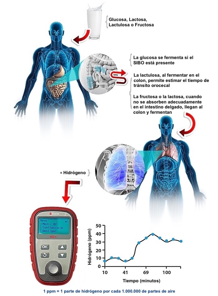 test de sibo en santiago